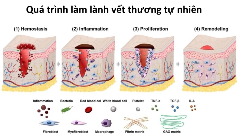 Vì sao chúng ta có thể bị bỏng? Phản ứng của cơ thể